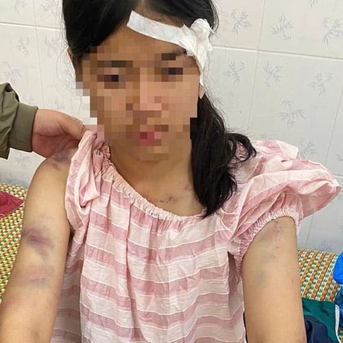 Bé gái 12 tuổi ở Thái Nguyên bị hành hạ 4 tiếng: Bà nội dương tính ma túy và loạt tình tiết gây phẫn nộ
