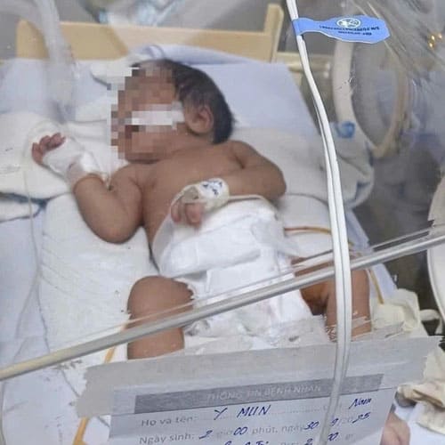 Bé gái 5 ngày tuổi thủng dạ dày vì mẹ cho ăn cơm: Cảnh báo đau lòng về sai lầm chăm con sơ sinh