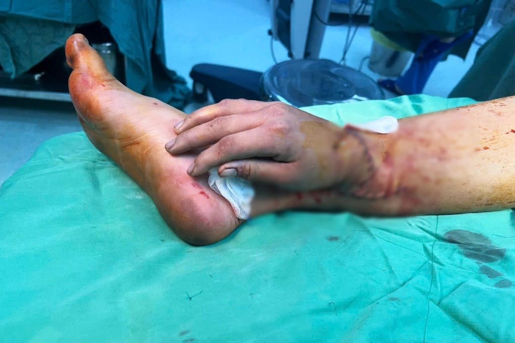 Bác sĩ bảo tồn bàn tay giúp mẹ trẻ chăm con trọn vẹn