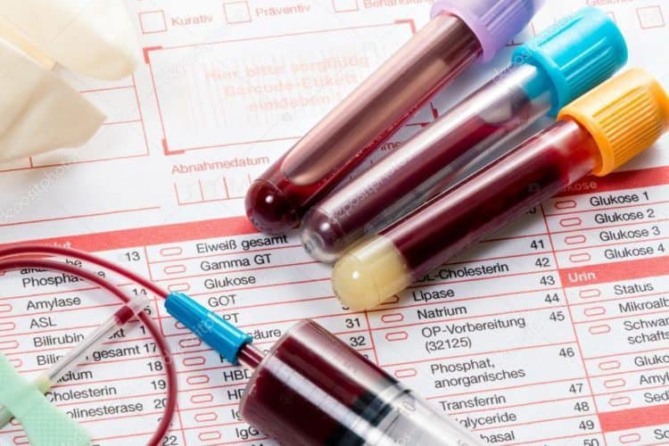 Tìm hiểu về viêm nội tâm mạc nhiễm khuẩn 2
