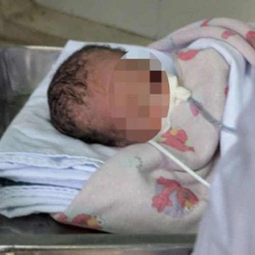 TPHCM: Hai ca sinh rớt, trẻ sơ sinh ngưng tim ngưng thở được cấp cứu ngoạn mục trong chưa đầy một tháng